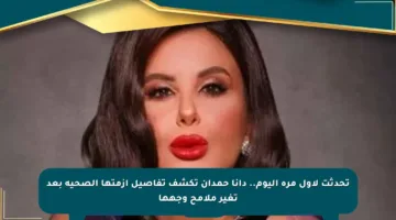 تحدثت لأول مرة اليوم.. دانا حمدان تكشف تفاصيل أزمتها الصحية بعد تغير ملامح وجهها
